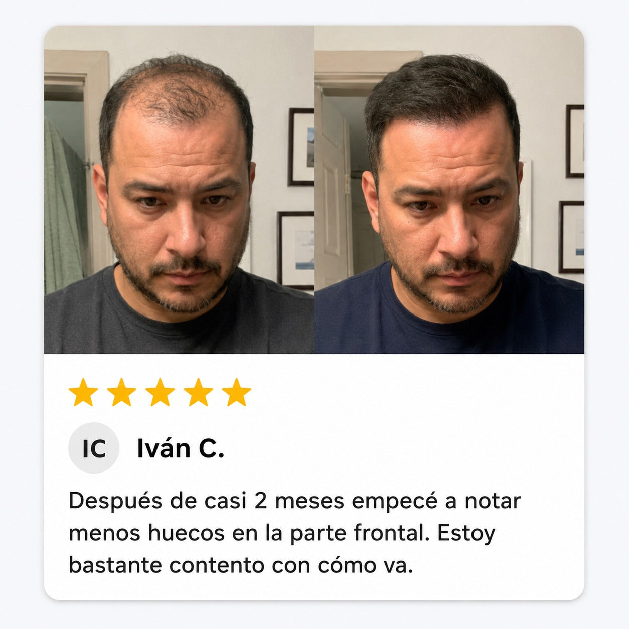 Excalvo - Javier Mejía