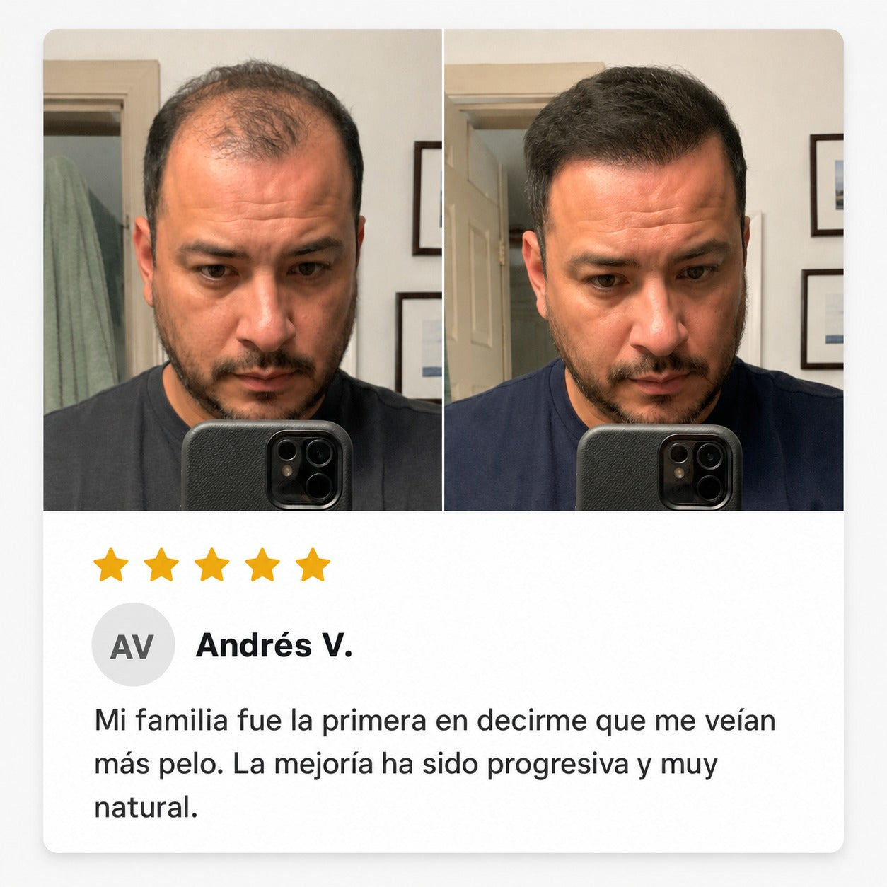 Excalvo - Pedro Ríos