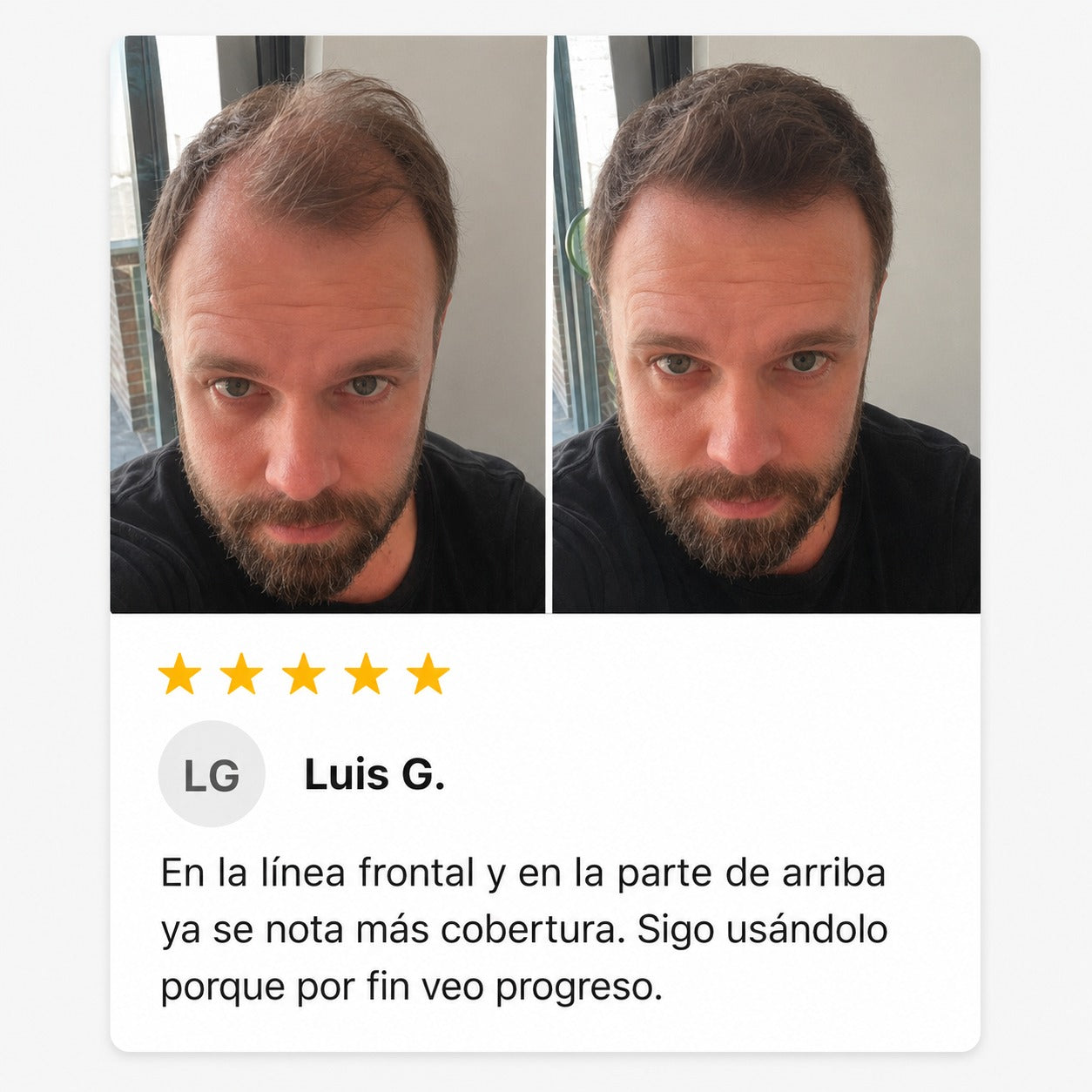 Excalvo - Pablo Ibarra