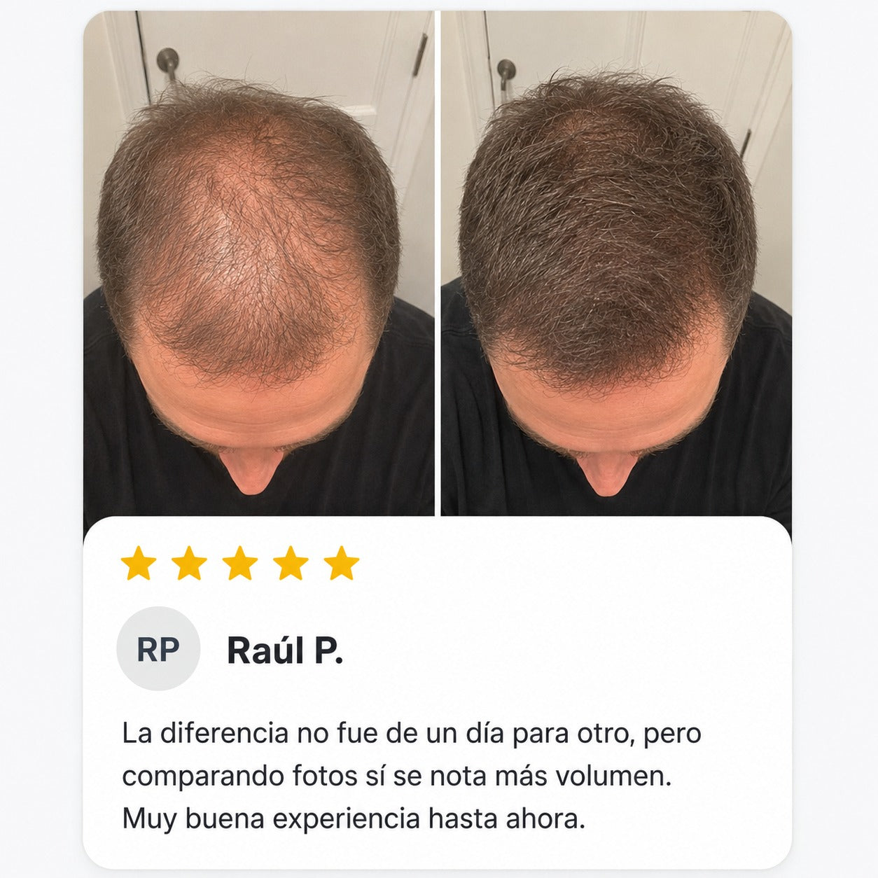 Excalvo - Gabriel Bermúdez
