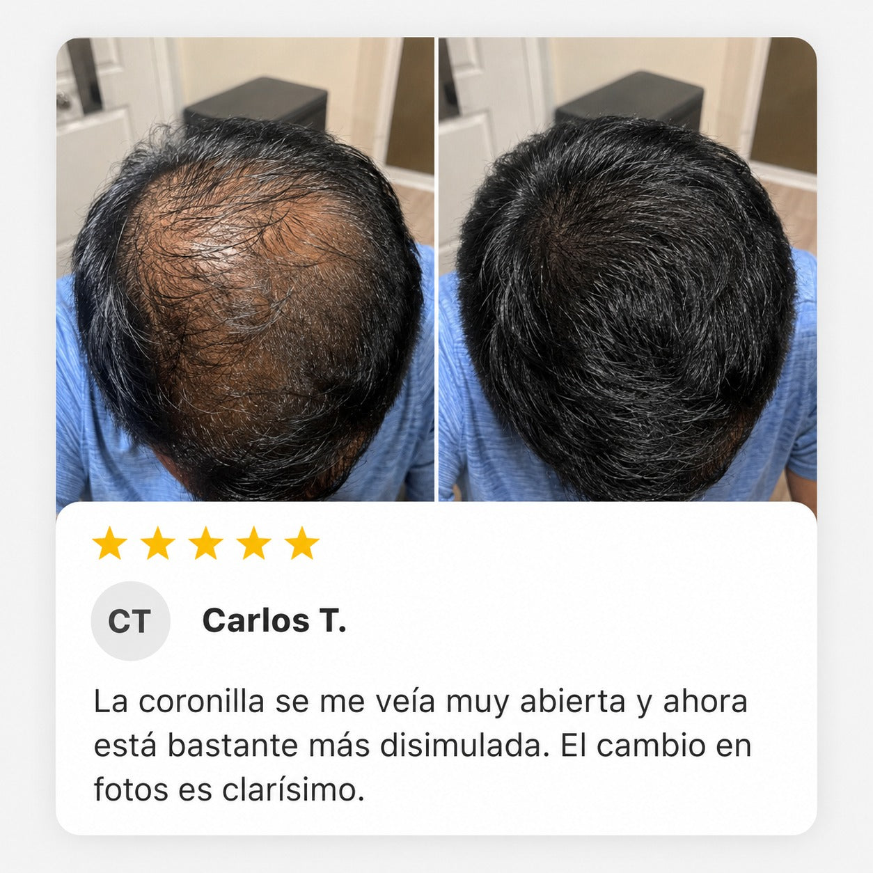 Excalvo - Antonio Ibarra
