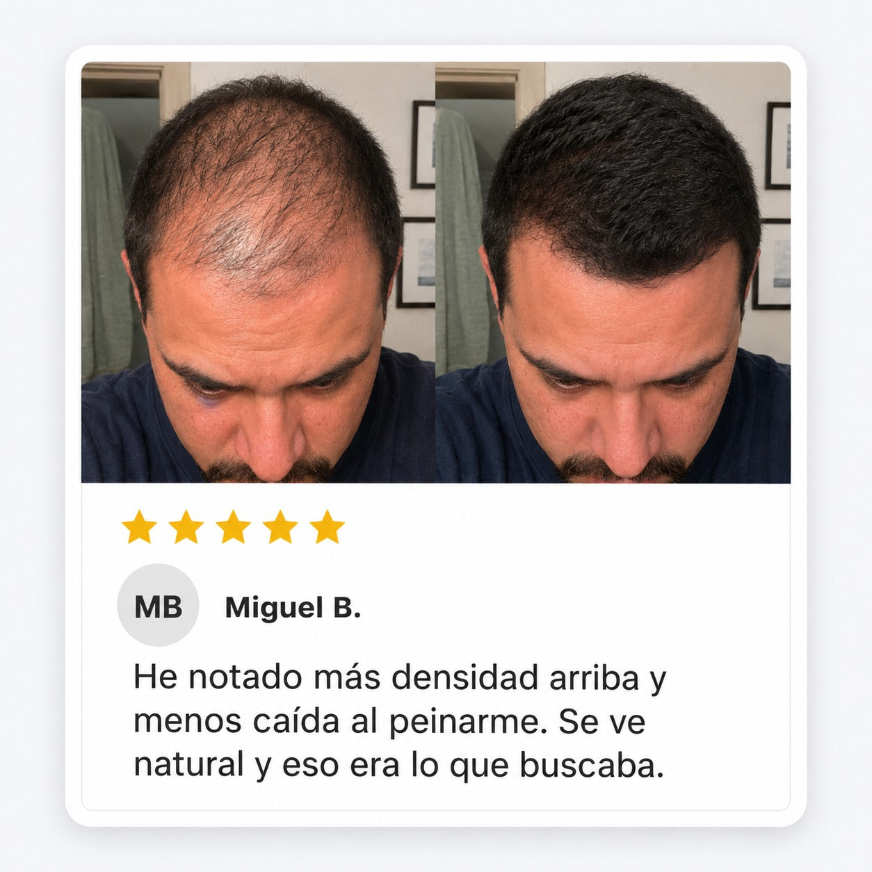 Excalvo - Miguel Bermúdez