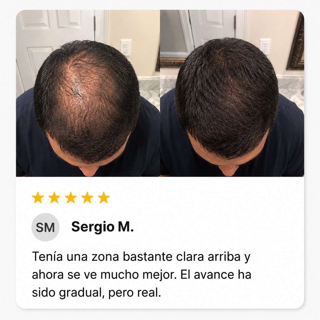 Excalvo - Antonio Padilla