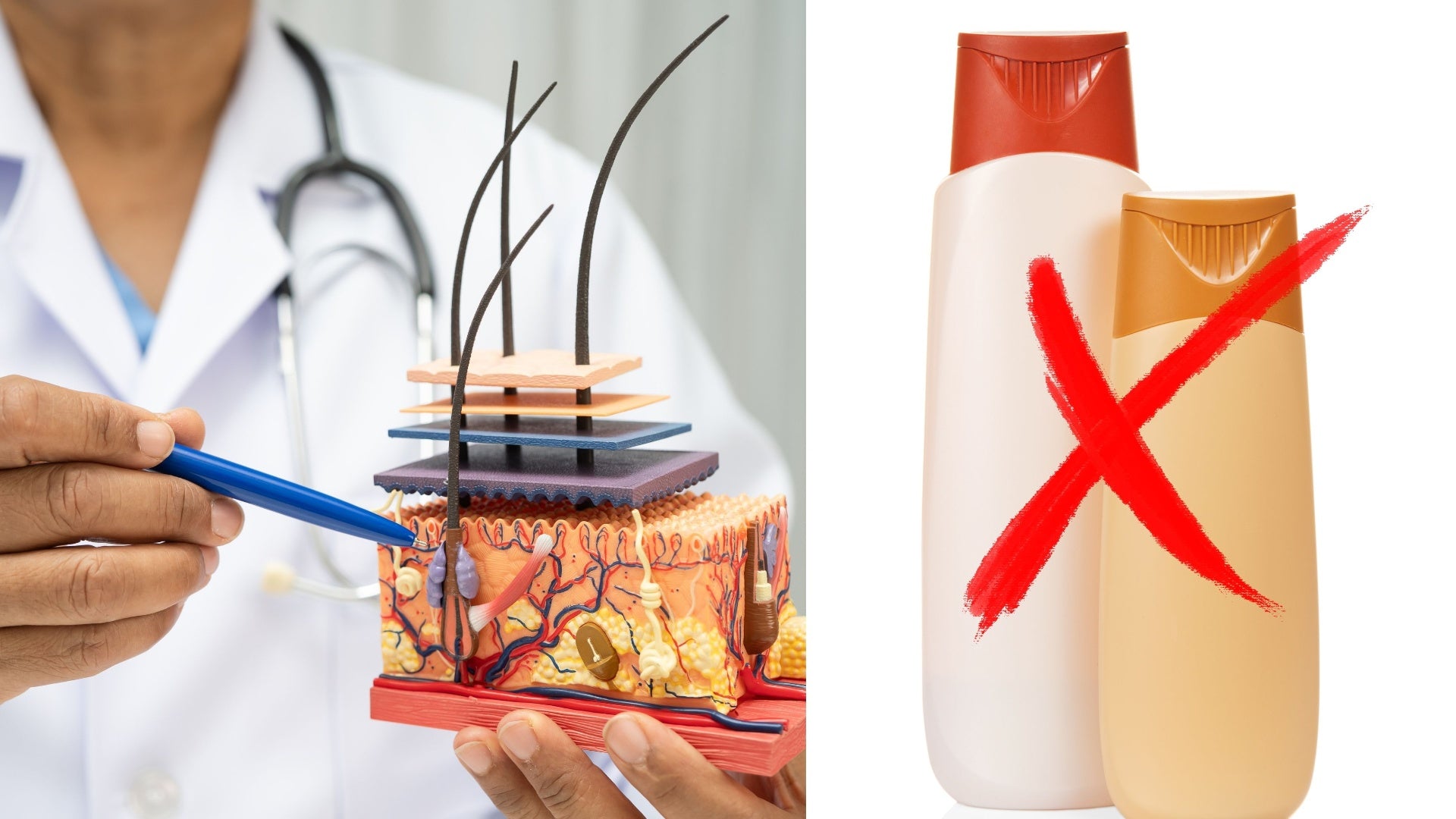 Doctor explicando el folículo y por qué los shampoos de farmacia no funcionan